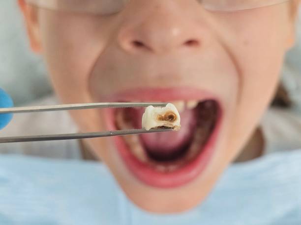 Best Emergency Care for Gum Disease in Madison, FL